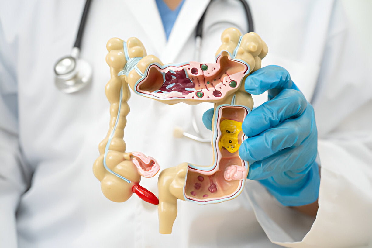 Gut Health